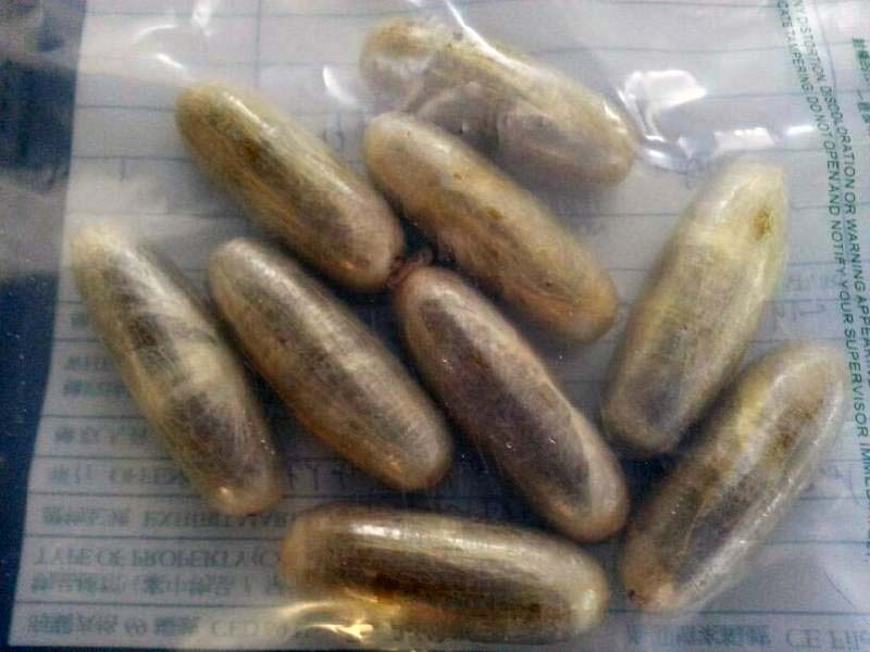 ניסה להבריח סמים בבטנו וסיים על שולחן הניתוחים ניסה להבריח סמים בבטנו וסיים על שולחן הניתוחים