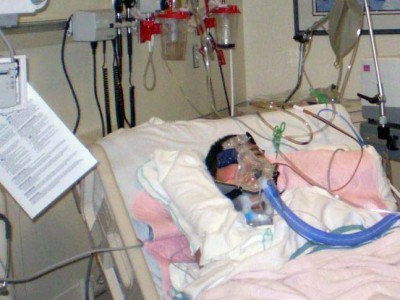 מגדל העמק: תינוק פונה לרמב״ם עם כוויות בדרגה ב׳