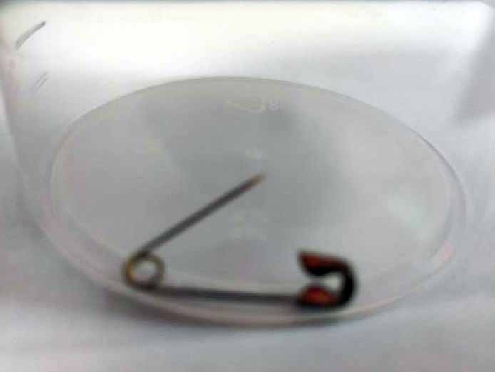 חייו של תינוק בן 8 חודשים ניצלו במרכז הרפואי העמק חייו של תינוק בן 8 חודשים ניצלו במרכז הרפואי העמק