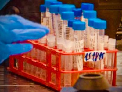 כללית מחוז צפון מודיעה על התחלת מבצע חיסונים כנגד וירוס הקורונה