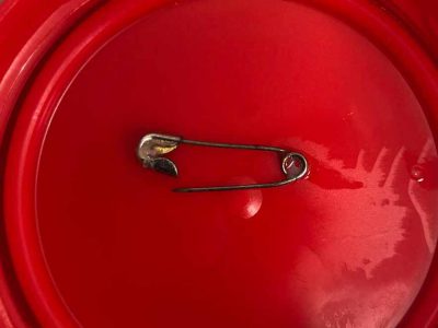 מסוכן: סיכת ביטחון פתוחה נשלפה מגרונו של פעוט ב"העמק" בעפולה