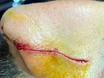 בעקבות ויכוח בכביש קטין דקר וחתך צעיר  בן 23